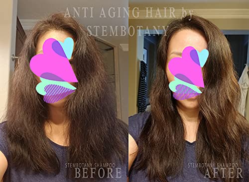 Stembotany Stem Cell šampon za stanjivanje kose ultimate hair Loss šampon za žene i muškarce: Frizz Control prirodni DHT Blocker šampon